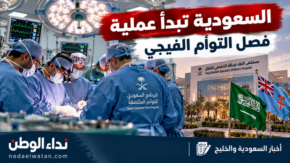 السعودية تبدأ عملية دقيقة لفصل التوأم السيامي الفيجي.. 15 ساعة و34 طبيبًا ومختصًا في الرياض
